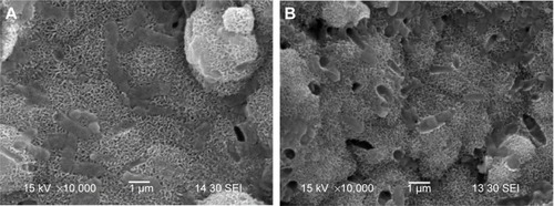 Figure 5 SEM images of surface morphology of l-MBPC (A) and l-BPC (B) scaffolds after soaking in SBF for 7 days.Abbreviations: SEM, scanning electron microscope; l-MBPC, Li-containing mesoporous bioglass/mPEG-PLGA-b-PLL composite; l-BPC, Li-containing bioglass/mPEG-PLGA-b-PLL composite; SBF, simulated body fluid.