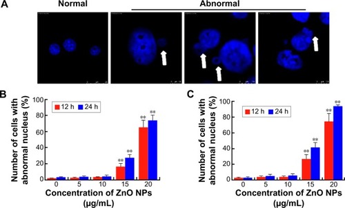 Figure 7 Nuclear DNA leakage in LCs and SCs after ZnO NP treatment.Notes: (A) DAPI staining shows nuclear DNA leakage (arrows) in cells incubated in the presence of ZnO NPs. Number of LCs (B) and SCs (C) with nuclear DNA leakage after 12 and 24 hours in the presence of ZnO NPs. The results are expressed as the mean ± standard deviation of three separate experiments, in triplicate. **P<0.01.Abbreviations: DAPI, 4′,6-diamidino-2-phenylindole; LCs, Leydig cells; NPs, nanoparticles; SCs, Sertoli cells; h, hours.