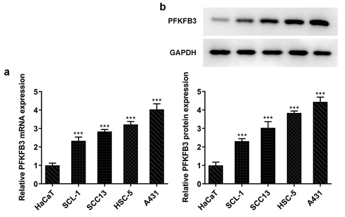 Figure 1. PFKFB3 is highly expressed in CSCC cells. (a) PFKFB3 mRNA expression and (b) PFKFB3 expression in CSCC cells and HaCaT cells was respectively examined using RT-qPCR and Western blot. ***P < 0.001 vs. HaCaT