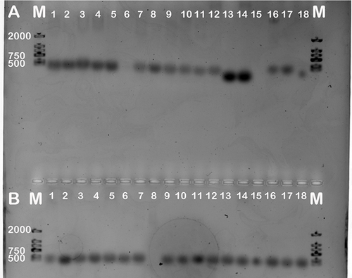 Figure 4 PCR results of genes (16sRNA gene, P36 gene, parC, parE, gyrA, gyrB) from M.hyo strains. Vaccine strains: RM48 strain, J strain, 168L strain, DJ-166 strain. Field strains: HNPQ strain, HNSH strain, AHFY strain. Conserved genes for identification of M.hyo:16sRNA gene, P36 gene. QRDR genes: gyrA, gyrB, parE and parC.