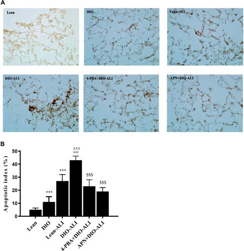 Figure 5 The effects of APN and 4-PBA on the apoptosis of pulmonary epithelial cells. (A) The apoptosis of epithelial cells was detected by TUNEL staining. TUNEL-positive cells observed under a light microscope were identified by brown-stained nuclei (images were taken at 200× magnification.). (B) The apoptotic index of the epithelial cells. A higher epithelial apoptosis ratio was found in the lung tissues of obese rats before ALI. Data are presented as the mean ± SD. ***p < 0.001 vs Lean; ###p < 0.001 vs DIO; ΔΔΔp <0.001 vs Lean-ALI; $$$p < 0.001 vs DIO-ALI.