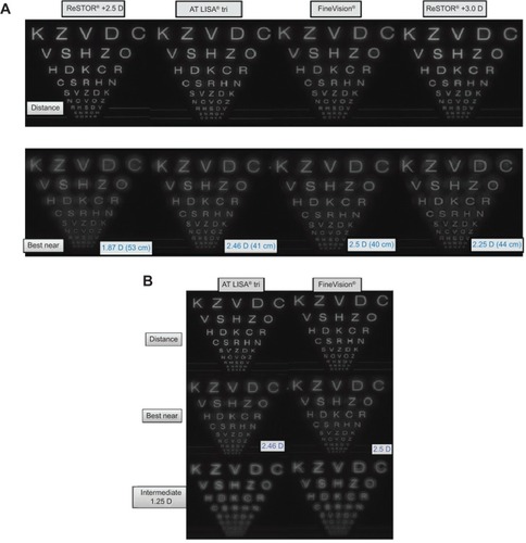 Figure 3 Image quality of the AT LISA® tri, FineVision®, ReSTOR® +2.5 D, and ReSTOR® +3.0 D IOLs at various focal distances.Notes: (A) Image quality through all IOLs at distance and best near focal distances. (B) Image quality through trifocal IOLs (AT LISA tri IOL and FineVision IOL) at intermediate focal distances. The smallest line on the chart corresponds with a visual acuity of 20/12. The third line (with the text “R H S D V”) and sixth line (with text “C S R H N”) from the bottom are equivalent to visual acuities of 20/20 and 20/40, respectively. AcrySof® IQ ReSTOR® IOLs, Alcon Laboratories, Fort Worth, TX, USA; AT LISA® tri 839MP IOLs, Carl Zeiss Meditec AG, Jena, Germany; FineVision® Micro F12 IOLs, PhysIOL SA, Liège, Belgium.