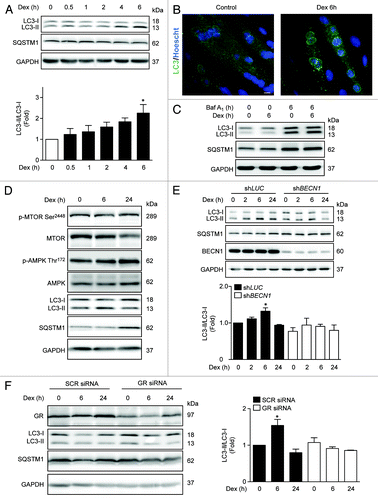 Figure 1. Western blot analysis of phosphorylated GR, LC3, SQSTM1, and GAPDH in L6 myotubes treated with Dex for indicated time points (A). LC3 and Hoechst 33342 immunofluorescence in L6 cells incubated with Dexamethasone for 6 h (B). Western blot analysis of LC3, SQSTM1, and GAPDH in L6 myotubes incubated with Baf A1 and/or Dex for 6 h (C). Western blot analysis of phophorylated MTOR, total MTOR, phosphorylated AMPK, total AMPK, LC3, SQSTM1, and GAPDH in L6 myotubes incubated with Dexamethasone for 0, 6, and 24 h (D). Western blot analysis of LC3, SQSTM1, BECN1, and GAPDH in LUC and BECN1 knockout L6 myotubes (E). Western blot analysis of GR, LC3, SQSTM1, and GAPDH in control and glucocorticoid receptor knockdown L6 myotubes (F). Data: mean ± SEM of at least 3 independent experiments. Statistically significant differences were calculated using ANOVA in combination with a Tukey test for group comparison. *P < 0.05 vs. control.