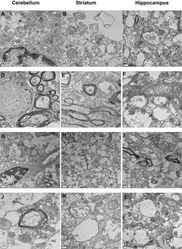 Figure 6 Transmission electron microscope images of the brain regions of a silica (SiO2) repeatedly treated rats.Notes: (A–C) Dermally administered SiO2EN20(−); (D–F) dermally administered SiO2EN100(−); (G–I) orally administered SiO2EN20(R); (J–L) orally administered SiO2EN100(R).
