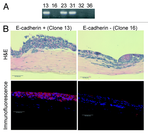 Figure 5. Re-expression of E-cadherin within the Inv-1a cells results in a thickened tissue formation and a reduction in the number of invasive cells. (A) RT-PCR for E-cadherin in Inv-1a clones that were infected with an E-cadherin-expressing retroviral vector showing E-cadherin expression. (B) H&E and immunofluorescence (E-cadherin – red; dapi – blue) staining of 3D tissues composed of either E-cadherin positive or E-cadherin negative Inv-1a cells. Scale bars = 100 µm.