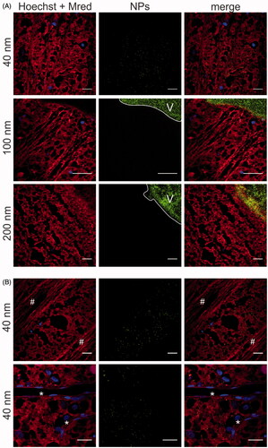 Figure 5. Transfer of (green) PS beads through the VR interface, as visualized by ‘direct imaging’ (Figure 2B). Müller cells (red) are stained with Mitotracker Deep Red, cell nuclei (blue) with Hoechst. (A) 40 nm particles enter the Müller cells, 100 and 200 nm particles remain in the vitreous (indicated with ‘V’). Scale bar: 25 µm. For optimal contrast we refer the reader to the online version. (B) Co-localization of 40 nm PS beads (green) with Müller cells. Asterisks (*) indicate blood vessels, number signs (#) indicate nerve fibers. Scale bar: 25 µm.