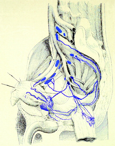 Figure 1. Lymphatic drainage of the prostate (Adapted from [2]).