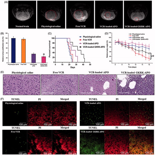 Figure 5. Anticancer efficacy in intracranial U87MG glioma-bearing mice. Notes: Efficacy after treatment with various formulations with a dose of 1 mg/kg VCR at days 8, 10, 12, and 14 from inoculation. MRI of normal and pathological brains at 16 day after inoculation (A). Inhibition of the brain glioma volume (B). Kaplan- Meier survival curves (C). Body weight changes (D). HE staining (E) and TUNEL analysis (F) of brain tumours. Red (the colour spots in PI): cell nuclei. Green (the colour spots in TUNEL): apoptosis cells. The data are presented as the means ± SD (n =6). * indicates P< 0.05.