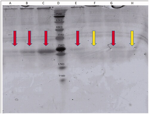 Figure 5. (A) 5 µg/lane HBsAg; (B) 10 µg/lane HBsAg; (C) 20 µg/lane HBsAg; (D) markers; (E) MNP + HBsAg + mannose precipitate; (F) MNP + HBsAg + mannose supernatant; (G) MNP + HBsAg precipitate; (H) MNP + HBsAg supernatant.