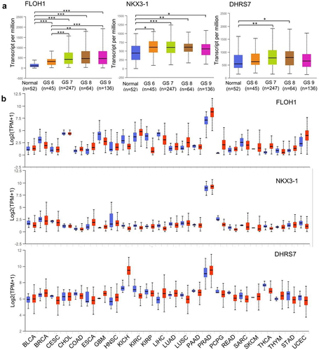 Figure 5. Expression of multiple-target genes in TCGA. (a)Expression of FLOH1, NKX3 and DHRS7 genes in PRAD based on patient’s GS. *,P < .05; **,P < .01; ***,P < .001. (b) Expression of FLOH1, NKX3 and DHRS7 genes across TCGA cancers. Blue bar: normal samples; Red bar: tumor samples. BLCA: Bladder Urothelial Carcinoma; BRCA: Breast invasive carcinoma; CESC: Cervical squamous cell carcinoma and endocervical adenocarcinoma; CHOL: Cholangiocarcinoma; COAD: Colon adenocarcinoma; ESCA: Esophageal carcinoma; GBM: Glioblastoma multiforme; HNSC: Head and Neck squamous cell carcinoma; KICH: Kidney Chromophobe; KIRC: Kidney renal clear cell carcinoma; KIRP: Kidney renal papillary cell carcinoma; LIHC: Liver hepatocellular carcinoma; LUAD: Lung adenocarcinoma; LUSC: Lung squamous cell carcinoma; PAAD: Pancreatic adenocarcinoma; PRAD: Prostate adenocarcinoma; PCPG: Pheochromocytoma and Paraganglioma; READ: Rectum adenocarcinoma; SARC: Sarcoma; SKCM: Skin Cutaneous Melanoma; THCA: Thyroid carcinoma; THYM: Thymoma; STAD: Stomach adenocarcinoma; UCEC: Uterine Carcinosarcoma.