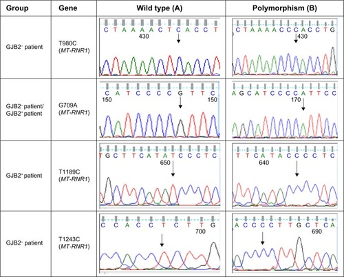 Figure 1 Comparison of sequence analysis of the polymorphism in MT-RNR1 and MT-ND1 and heterozygous GJB2 genes among patients with GJB2 mutation (GJB2+) and without GJB2 mutation (GJB2−).