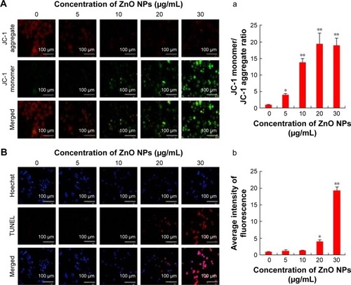 Figure 4 Effects of ZnO NPs on mitochondrial membrane permeability and apoptosis in SKOV3 cells.Notes: SKOV3 cells were treated with ZnO NPs (0, 5, 10, 20, and 30 μg/mL) for 12 h. (A) Mitochondrial membrane potential (∆ψm) was evaluated using JC-1 in treated cells. Red fluorescence indicates JC-1 aggregates within the mitochondria in healthy cells, whereas green fluorescence indicates JC-1 monomers in the cytoplasm and loss of ∆ψm. Scale bars =100 μm. (a) Ratio of JC-1 monomers to JC-1 aggregated. (B) Apoptosis was assessed in a TUNEL assay; the nuclei were counterstained with DAPI. Representative images show apoptotic (fragmented) DNA (red staining) and the corresponding cell nuclei (blue staining). (b) The average intensity of TUNEL fluorescence in SKOV3. Scale bars =100 μm. *P<0.05; **P<0.01.Abbreviations: DAPI, 4′,6-diamidino-2-phenylindole; TUNEL, terminal deoxynucleotidyl transferase-mediated dUTP nick end labeling; ZnO NPs, zinc oxide nanoparticles.