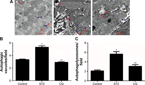 Figure 5 Representative electron micrographs of autophagic vacuoles.