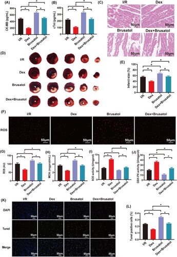 Figure 5. The effects of Brusatol administration on the protection of Dex postconditioning against myocardial IRI. (A) and (B) Serum CK-MB and cTnI levels (n = 5); (C) Pathological changes of myocardial damages observed by HE staining (n = 3), magnification, ×200, bar = 50 μm; (D) and (E) Infarct sizes determined by the Evans blue and TTC staining (n = 6); (F) and (G) Immunofluorescence of ROS (n = 6), magnification: ×200, bar = 50 μm; (H) Myocardial MDA level (n = 6); (I) and (J) Myocardial SOD and GSH-PX activities (n = 6); (K) and (L) Cardiomyocyte apoptosis assessed by the Tunel assay (n = 6), magnification: ×200, bar = 50 μm. Date was expressed as the mean ± SEM. *P < .05.