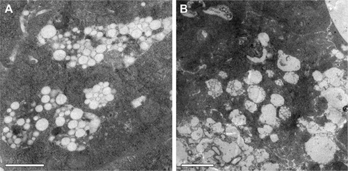 Figure 4 Intracellular accumulation of nanospheres in BMDCs treated with PHYP under TEM. Scale bar (A and B) represents 1 and 2 µm, respectively.Abbreviations: BMDCs, bone marrow dendritic cells; PHY, pachyman; PHYP, PHY-encapsulated PLA; TEM, transmission electron microscope.