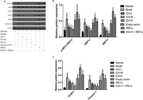 Figure 4. ICA suppressed the protein expression of IRE1α/XBP1 inflammatory signal axis induced by OGD/R. Microglia were suffered from 2 h of OGD followed by 24 h reoxygenation. ICA (0.37, 0.74 and 1.48 μmol/L) administration was performed 1 h before OGD and acting through 2 h OGD. IRE1α, p-IRE1α, XBP1u, XBP1s, NLRP3 and caspase-1 protein expression was examined by WB. Data are expressed as mean ± SD of three independent experiments. ##p< 0.01 vs. normal control group; *p< 0.05, **p< 0.01 vs. OGD/R group; ^^p< 0.01 vs. ICA-H group. ICA-L: 0.37 μmol/L ICA, ICA-M: 0.74 μmol/L ICA and ICA-H: 1.48 μmol/L ICA.