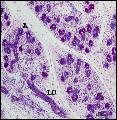 Figure 6. Photomicrograph of 21.2 cm CVRL (122nd day) buffalo foetus showing localization of neutral mucopolysaccharides in acinar cells (A) and large ducts (LD) of mandibular gland. Periodic Acid Schiff’s method ×100.
