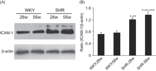 Figure 4. Western blot analysis shows that SHR promotes ICAM-1 expression. (A) Kidney lysates of 28w and 56w kidneys from WKY and SHR rats were examined using western blotting for ICAM-1 and reprobed for β-Actin as a loading control. (B) Semi-quantitative analysis of ICAM-1. Data are shown as means ± SD.Notes: *p < 0.05 versus 28w-WKY rats; **p < 0.05 versus 56w-WKY rats; ***p < 0.05 versus 28w-SHR rats.