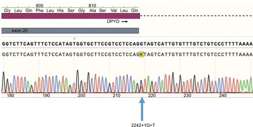 Figure 1 Sequence electropherogram of the 2242+1G>T variant. Blue, dCTP; green, dATP; black, dGTP; red, dTTP.Abbreviations: dATP, deoxyadenosine triphosphate; dCTP, deoxycytidine triphosphate; dGTP, deoxyguanosine triphosphate; DPYD, dihydropyrimidine dehydrogenase; dTTP, deoxythymidine triphosphate.