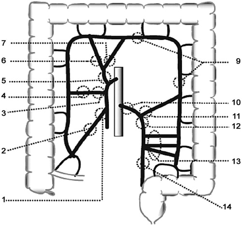 Figure 1. The placements of the proximal vascular ligatures as presented in the registration form of the Swedish Colorectal Cancer Registry.
