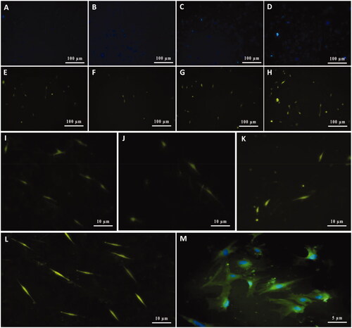 Figure 7. Characterization of cultivated MSCs on SCs-imprinted substrate by anti-p75NTR antibody after 3 weeks. Cell nuclei were stained with Hoechst (A–D) and then characterized by the anti-p75NTR antibody (E–H). Differentiated MSCs show immunoreactive for the p75NTR marker (E–H). Higher magnification of some SCs differentiated from MSCs (I–M). Similar to S100β, MSCs which cultured on the plain substrate were negative for the p75NTR marker (not shown).
