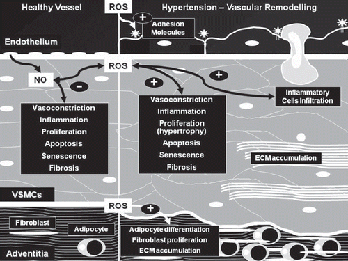 Figure 1. ROS and vascular remodeling in hypertension. In healthy vessels, endothelial cells produce NO and ROS, where they play a role in cellular signaling related to the control of endothelial function and maintenance of vascular integrity. In hypertension, increased ROS production, due to increased activity of pro-oxidant enzymes and decreased antioxidant defense systems, and decreased NO bioavailability, are associated with endothelial dysfunction and vascular remodeling. Exposure of endothelium to high concentrations of ROS induces hypertrophy and expression of adhesion molecules with infiltration of inflammatory cells. In VSMCs, ROS activate profibrotic, proliferative, and apoptotic pathways leading to increased extracellular matrix (ECM) accumulation (fibrosis), hypertrophy, and fibrosis. The adventitia is also responsive to high levels of ROS and, through adventitial fibroblasts and adipocytes, plays a role in the regulation of cellular responses in vascular remodeling.