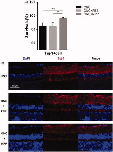 Figure 6. (A) Comparison of the survival rate between ONC and ONC + PBS and ONC + MPP; (B) The results of Tuj-1 immunofluorescence staining. After the miRNA/NP-BRZ treatment, the survival rate of Tuj-1+ cells in ONC + miRNA/NP-BRZ group was much higher than that in ONC group (**p < .01) and ONC + PBS group (**p < .01). There was no significant difference between ONC group and ONC + PBS group (p > .05). Scale bar: 40 μm. Statistical significance was set at p < .05. miRNA/NP-BRZ: drug-loaded nanoparticles; ONC: optic nerve crush; PBS: phosphate-buffered saline.