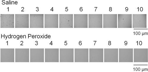 Figure 3 Photographs of pollen particles attached to the inner surface of a soft contact lens (SCL) after washing with physiological saline or hydrogen peroxide. Bars = 100 µm.
