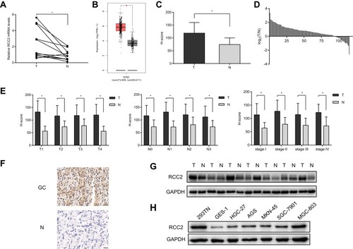 Figure 1 RCC2 is upregulated in gastric cancer. (A) Eleven paired samples of gastric cancer tissues (T) and adjacent normal tissues (N) were investigated by quantitative RT-PCR. The RCC2 mRNA level was significantly higher in gastric cancer tissues than in normal tissues. *P<0.05. (B) The RCC2 mRNA level was significantly higher in gastric cancer tissues (T) than in normal tissues (N) in the TCGA and GTEx databases using GEPIA. *P<0.05. (C) The RCC2 protein level was significantly higher in tumor tissues (T) than in adjacent normal tissues (N) according to IHC and H-score. *P<0.05. (D) Log2(T/N) value of the RCC2 H-score of the analyzed samples. T and N represent tumor tissues and adjacent normal tissues, respectively. (E) The RCC2 H-score was higher in tumor tissues (T) than in normal tissues (N) in samples with different T, N, and pathological stages. RCC2 levels were measured using IHC. *P<0.05. (F) Representative IHC images from tumor and normal tissues. Positive staining for RCC2 was found mainly in tumor tissues. Scale bar, 20 µm. (G) RCC2 expression was higher in tumor tissues than in adjacent normal tissues for most paired samples. (H) RCC2 expression in 293TN, GES-1, HGC-27, AGS, MKN-45, SGC-7901 and MGC-803 cell lines.