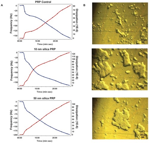 Figure 2 Effects of silica nanoparticles on platelet aggregation using quartz crystal microbalance with dissipation. Perfusion of fibrinogen-coated polystyrene-coated quartz crystals with platelet-rich plasma in the presence of silica nanoparticles leads to platelet aggregation. (A) Representative traces from the third overtone recorded by the device showing the effects of platelet-rich plasma in the presence or absence of silica nanoparticles on frequency (blue line, left axis) and dissipation (red line, right axis). (B) Representative micrographs of the surface of fibrinogen-coated polystyrene-coated quartz crystals as viewed by phase contrast microscopy showing increased accumulation of platelet aggregates following perfusion of platelet-rich plasma in the presence of silica nanoparticles.Abbreviations: min, minutes; PRP, plasma-rich protein; sec, seconds.