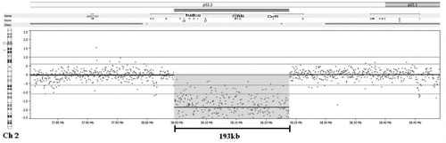 Figure 1.  Homozygous deletion and breakpoints in chromosome 2, encompassing the entire CYP1B1 gene, including exons 1–2 of the C2orf58 (chromosome 2 open reading frame 58, MGC34824) gene, and exons 3–11 of the FAM82A1 (Family with sequence similarity 82, member A1). CNV regions are indicated by the pink bars. The double red bars indicate the area of the 193 kb deletion. Exons of the genes involved are indicated by marks below each gene name. Probes are indicated by dots. The median probe spacing for this array is 575 bp. The area of the deletion is indicated by the pink highlighted area encompassing the probes which occur on the scale below the normal variation, indicative of a homozygous deletion.