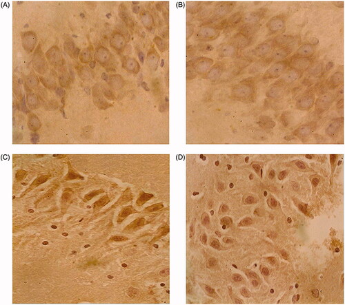 Figure 5. Results of immunohistochemistry for IL-1β expression detection in the hippocampus (CA1-3). A: Group I; B: Group II; C: Group III; D: Group IV. Magnification, 400×.