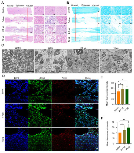 Figure 5 Histomorphological changes at 8 weeks post-injury in vivo. (A) Images of spinal cord tissue after staining with H&E, shown at 2X (left, scale bar = 500 μm) and 20 X magniﬁcation (right, scale bar = 50 μm). The images on the right are the corresponding enlarged views of the areas indicated by blue squares in the left images. The red lines indicate the edge of the lesion sites. (B) LFB staining of myelin sheaths is shown at 2X (left, scale bar = 500 μm) and 20X magniﬁcation (right, scale bar = 50 μm). The images on the right are the corresponding enlarged views of the areas indicated by blue squares in the left images. The red lines indicate the edge of the lesion sites. (C) Representative TEM images showing the ultrastructure of myelin sheaths in different groups. Scale bar = 5 μm. (D) Double-staining of the slices with anti-NF200 and anti-NeuN antibodies. Scale bar = 50 μm. (E) Quantitative analysis of mean ﬂuorescence intensity of NF200 staining in Figure 4D, * P< 0.05, in comparison with saline group. (F) Quantitative analysis of mean ﬂuorescence intensity of NeuN staining in Figure 4D. * P < 0.05 and ** P < 0.01, in comparison with saline group.