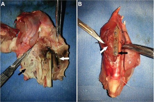 Figure 5 Macroscopic findings of the surgical site at week 4 after implantation. (A) Pus (black arrow) and necrotic tissue (white arrow) were observed in the groups without drug. (B) Basic normal bone and soft tissue (white arrow) were observed around the titanium implant, which was coated with incomplete degraded white vancomycin-loaded coating (black arrow).