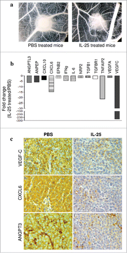 Figure 4. Role of IL-25 on in vivo tumor angiogenesis. (A) CAM assay performed ex vivo with tumor masses explanted from PBS (left panel) or hrIL-25 (right panel) treated mice. (B) Gene expression profiling of human angiogenesis related genes in SU-DHL-4 tumors explanted from SCID/NOD mice as assessed by PCR Array. Results represent fold differences in individual mRNA expression between PBS or hrIL-25 treated mice. Pooled results from 4 different experiments are shown. (C) Immunohistochemical analysis of the expression of selected pro-angiogenic molecules in SU-DHL-4 tumors from PBS or hrIL-25 treated mice. In comparison with tumors developed in PBS treated mice (a-c), the small tumor masses from hrIL-25 treated mice showed very low expression of VEGF-C (d), CXCL6 (e) and ANGPT3 (f).