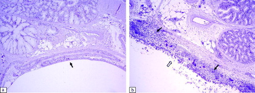 Figure 5.  Histopathological lesions of the infraorbital sinus epithelium at 6 d.p.i. (H & E stain, 100x magnification). 5a: Control group. 5b: Infraorbital sinus epithelium of an aMPV subtype-B-inoculated broiler showing infiltration of lymphoid cells (black arrow) and destruction of the epithelium (white arrow). Infraorbital sinus epithelium of an aMPV subtype-A-inoculated broiler shows similar lesions.