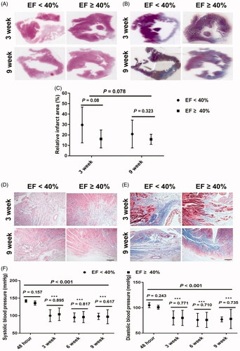 Figure 2. Representative pathologic changes of infarct heart and changes of blood pressure after losartan treatment in rats post-MI. (A) Representative ventricular sections of MI by hematoxylin and eosin staining at 3 and 9 weeks (original magnification, ×6). (B) Representative ventricular sections of MI by Masson’s trichrome staining at 3 and 9 weeks (original magnification, ×6). (C) Relative infarct area based on the data from hematoxylin and eosin staining and Masson’s trichrome staining at 3 and 9 weeks. (D) Representative changes of cardiac myocytes in infarct border zone by hematoxylin and eosin staining at 3 and 9 weeks (original magnification, ×200). (E) Representative changes of cardiac fibrosis in infarct border zone by Masson’s trichrome staining at 3 and 9 weeks (original magnification, ×200). (F) Changes of blood pressure 48 h post-MI and 3, 6 and 9 weeks after losartan treatment post-MI, ***p < 0.001 vs. 48 h timepoint. MI: myocardial infarction; EF: ejection fraction.