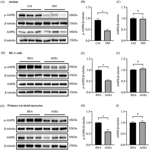 Figure 4 Inactivation of AMPK in atrial of diabetic rats and AGEs treated atrial cells. (A) Representative blots of p-AMPK (n=6) and AMPK proteins (n=12) in atrium of diabetic rat. (B and C) Densitometry analysis of p-AMPK (n=6) and AMPK (n=12) proteins in atrium of diabetic rat. (D) Representative blots of p-AMPK and AMPK proteins in each HL-1 cell group (n=6). (E and F) Densitometry analysis of p-AMPK and AMPK proteins in each HL-1 cell group (n=6). (G) Representative blots of p-AMPK and AMPK proteins in each primary rat atrial myocyte group (n=6). (H and I) Densitometry analysis of p-AMPK and AMPK proteins in each primary rat atrial myocyte group (n=6). *p<0.05, #p>0.05.