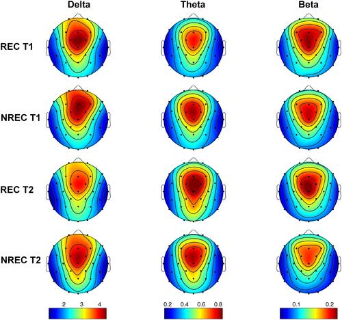 Figure 2 Topographic distribution of EEG powers during the last 5-min of rem sleep preceding awakenings. The EEG activity for the delta (0.5–4.75 Hz), theta (5–7.75 Hz) and beta (16–24.75 Hz) frequency bands is reported, expressed as percentage of the total EEG power within the whole topography. The maps are scaled between the minimal and maximal power values for each frequency band considering the recall (REC) condition during T1 (1st row) and T2 (3rd row), and non-recall (NREC) condition during T1 (2nd row) and T2 (4th row). The maps are based on 28 derivations (electrode positions indicated by black dots) with averaged mastoid reference. Values are color-coded and plotted at the corresponding position on the planar projection of the hemispheric scalp model. Values between electrodes were interpolated (biharmonic spline interpolation).