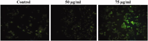 Figure 6. MT-AuNPs induce intracellular ROS generation in HepG2 liver cancer cells.