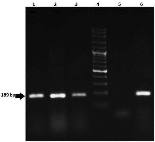 Figure 4. Agarose gel electrophoresis of PCR products from maize samples for analysis of Bt11 (189 bp) line. Lanes 1–3: positive samples; Lane 4: 100 bp DNA ladder; Lane 5: negative control; Lane 6: positive control