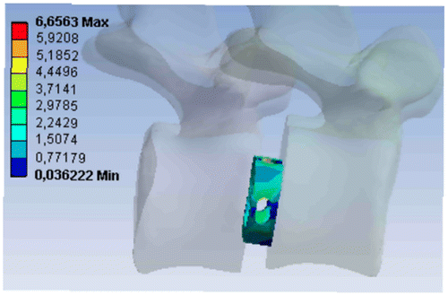 Figure 3. Von Mises stress distribution in first cage.