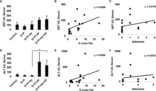 Figure 5 At 48 weeks mice were sacrificed. Whole blood was collected from control, D+P, D+P+Hx, D+P+HF, and D+P+Hx+HF mice, via cardiac puncture. Serum was separated from the whole blood and analyzed for the levels of alanine aminotransferase (ALT) and aspartate aminotransferase (AST). (A) Graphs the units per liter of serum. Each bar represents the average AST for all the animals in each of the groups. Error bar represents the standard error. (B) Data for AST levels and percent liver fat were pooled for all of the animals, and the levels of AST were compared with the percent liver fat using Spearman’s rank correlation coefficient test (r=0.63, p=<0.01, n=17). (C) A similar test for the correlation between serum AST levels and the number of adenomas per mouse was conducted also using the Spearman’s rank correlation coefficient test (r=0.52, p=<0.05, n=18). (D) The average serum levels of ALT in units per liter serum for each of the animal groups is depicted. Error bars represent the standard error. An asterisk indicates a statistically significant difference between groups (p <0.05). (E) Data for ALT serum levels and percent liver fat were pooled for all of the animals and the levels of ALT compared with the percent liver fat using Spearman’s rank correlation coefficient test (r=0.6, p=<0.02, n=17). (F) The graph shows a Spearman’s rank correlation coefficient test of ALT serum levels and the number of adenomas per animal (r=0.46, p=not significant, n=18). *p<0.05.