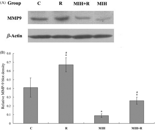 Figure 5. Western blot analysis of MMP-9 expression in the primary tumour. (A) 25 days after the treatments, primary tumour tissue lysates from nine mice in each treatment group were subject to western blot analysis for MMP-9 expression. β-actin blotting was used as a loading control. Representative results are shown in this figure. (B) MMP-9 and β-actin blots were measured by densitometry. The density of the MMP-9 blot was normalised against that of β-actin to obtain a relative MMP-9 blot density. Treatment groups: C, tumour-bearing control; R, radiotherapy; MIH, magnetic induction hyperthermia; MIH + R, magnetic induction hyperthermia plus radiotherapy. *P < 0.05 compared with group C; #P < 0.05 compared with group MIH + R.