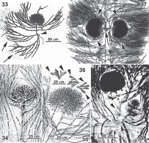 Figs 33–38. Entwisleia bella. Mature cystocarps. Specimens illustrated are FJS 6119 (Figs 33–37, from slide D) and FJS 6120 (Fig. 36, from slide A). 33. A mature cystocarp terminating a carpogonial branch borne on a periaxial cell (arrowhead) to which both a rhizoid and two unilaterally branched cortical filaments (arrows) are attached, the proximal laterals on carpogonial-branch cells more regularly subdichotomous throughout and forming a lax involucre around the compact carposporophyte. 34, 35. Early gonimoblasts on carpogonial branches with unbranched laterals. 36. Terminal carposporangia (arrowheads) on gonimoblast filaments dislodged from the cystocarp of Fig. 35. 37. A pair of equally developed mature cystocarps borne with involucral filaments (arrowheads) on a common periaxial cell (arrow). 38. Mature and young cystocarps borne on carpogonial branches attached to separate periaxial cells (arrowheads) at an axial node.