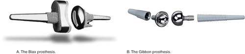 Figure 1. A. The Biax prosthesis. B. The Gibbon prosthesis.