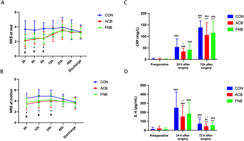 Figure 3 NRS scores of visceral pain and serum stress indexes were analysed during operation. (A and B) ACB and FNB group reduced visceral pain scores at rest 2 h postoperatively (A) and in motion at 6 h postoperatively (B) compared with CON group. Patients in ACB and FNB group remained significantly lower visceral pain scores at rest until 12 h postoperatively (A) and in motion until 24 h postoperatively (B). Data are expressed as mean ± SD. (C and D) Serum CRP and IL-6 contents were measured at pre-operation, 24 h and 72 h post-operation. Data are expressed as median (interquartile range). Compared with pre-operation, the concentrations of (C) CRP and (D) IL-6 at 24 h, 72 h after surgery were significantly higher among all groups. At 24 h after surgery, the concentrations of the CRP and IL-6 in ACB group were significantly lower than those in CON group, with statistically significant differences. However, at 72 h after surgery, only the concentrations of IL-6 in ACB group were significantly lower than those in CON group, with statistically significant differences. Analysis was performed using mixed effect models followed by Bonferroni’s test. *P<0.05 and **P<0.01 indicates statistically significant differences between ACB and CON group, #P<0.05 indicates statistically significant differences between FNB group and CON group. &&P<0.01 and &&&P<0.001 indicates statistically significant differences when compared with pre-operation, +++P<0.001 indicates statistically significant differences when compared with 24 h after surgery. P values are corrected using Bonferroni correction.