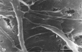 FIG. 1 Control zero time. Most of the cells are distended, with few rounding cells (double arrows) already extant. Note gaps on cells' membranes (hollow arrows), microvilli (arrowheads), extensive system of pleiomorphic filopodia (solid arrows), and an early phase of autoschizic event (A). The culture is nearly confluent, with tiny open spaces among cells (1c) and small bare islands (1d) Bar: (a) 1 µm; (b) 10 µm; (c) 100 µm; (d) 1 mm.