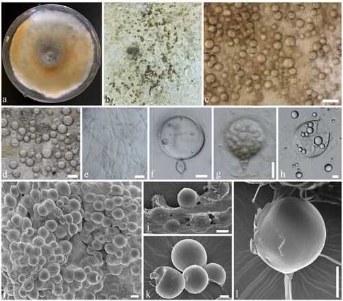 Figure 3. Mortierella multispora (KUMCC 20-0005, ex-type). a Colony on PDA, shown from above, grown for 60 days at 28°C. b Sporangia mass form under media. c, d Sporangia. e Mycelia. f, g Sporangia attached with tip of sporangiophores. h Sporangiospores. i–l Sporangia under a SEM. Scale bars: b = 50 µm, c, e, i, j = 20 µm, d = 40 µm, e = 2 µm, f = 5 µm, g, h, k, l = 10 µm.