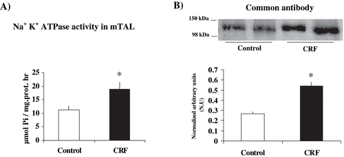 Figure 1. Differences in Na+ K+ ATPase activity and total Na+ K+ ATPase expression in outer renal medulla of control and CRF rats: (a) Na+ K+ ATPase activity was measured in outer renal medulla membranes by hydrolysis of [γ-32P]ATP; values are means ± SEM and expressed as μmol Pi / mg. prot . hr, and (b) Na+ K+ ATPase expression was measured in outer renal medulla homogenates using a common monoclonal antibody that recognizes total Na+ K+ ATPase α1-subunit independently of its phosphorylation degree; values are means ± SEM and were expressed as normalized arbitrary units. Normalized arbitrary units were obtained as total Na+ K+ ATPase α1-subunit expression with common antibody per μg protein. Na+ K+ ATPase activity and total Na+ K+ ATPase expression were increased in CRF rats as compared with control rats. *p < 0.05, as compared with control rats.